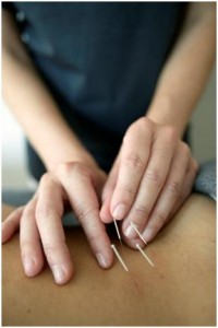 acupuncture business plan